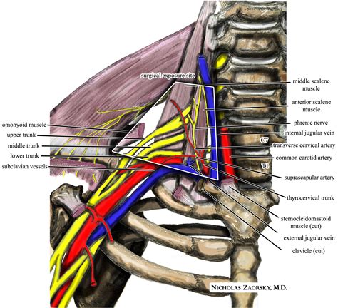 Filewikipedia Medical Illustration Thoracic Outlet Syndrome Brachial