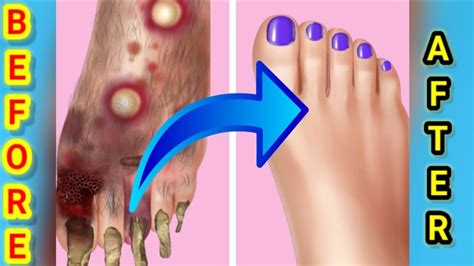 asmr foot treatment foot treatment in asmr asmr youtube