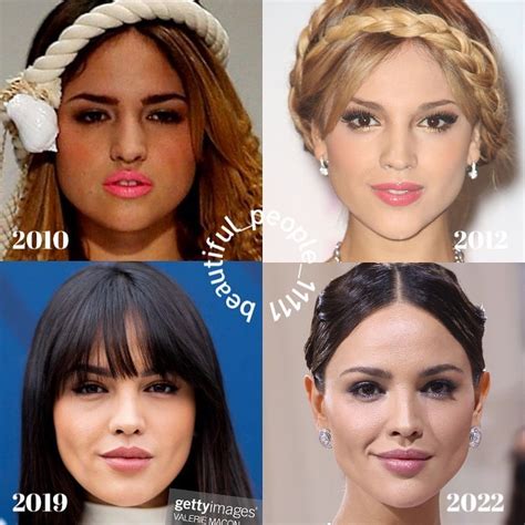 Rate Eiza Gonzalez Before And After Plastic Surgery Rvindictaratecelebs