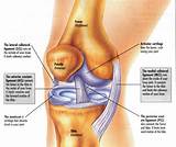 Meniscus Muscle Strengthening Exercises Photos