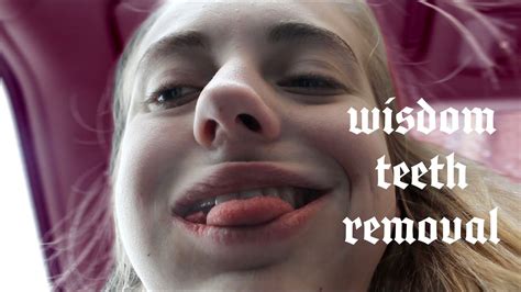 Maybe you would like to learn more about one of these? Year 3000 | Wisdom Teeth Removal - YouTube