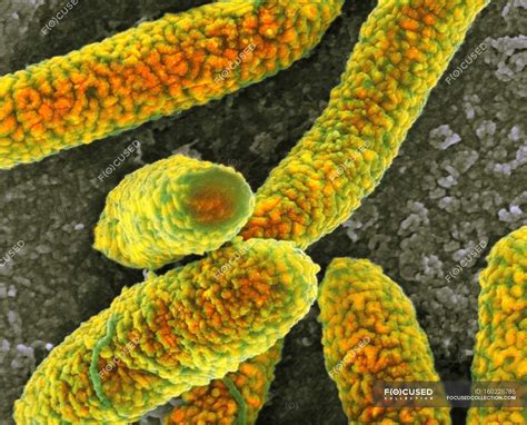 Escherichia Coli Bacteria Microbial Micrograph Stock Photo Sexiz Pix