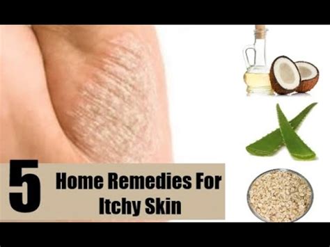 How to make my feet stop itching. Itchy Skin | Home Remedies for Itchy Skin - YouTube