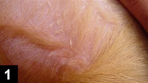 Scaling And Crusting Skin Disease Clinicians Brief