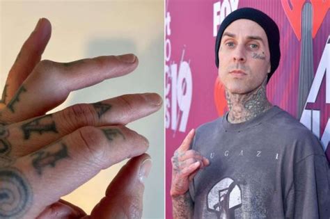 Travis Barker Gets Ready For Surgery And Shares Graphic Photos Of His Injured Ring Finger