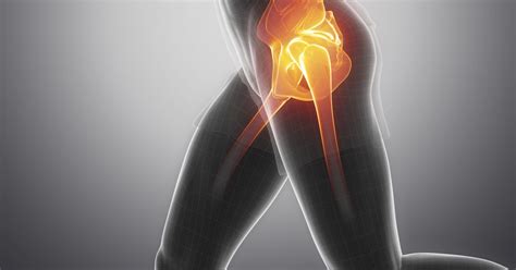 Nine Signs You May Need A Hip Replacement According To Somerset Hospital Somerset Live