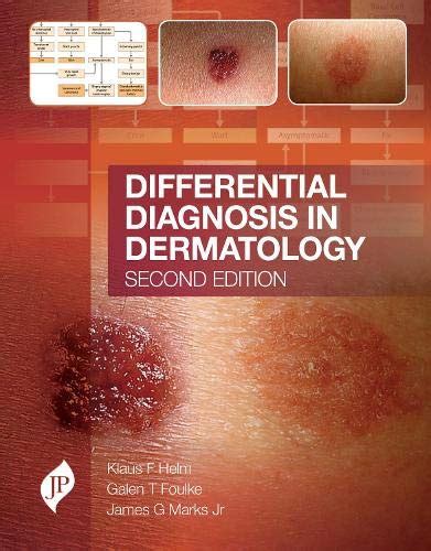 Differential Diagnosis Dermatology Second Abebooks