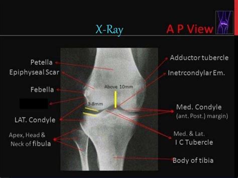Mri Knee Joint Anatomy