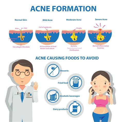 Back Acne Causes Types How To Get Rid Scar Treatments