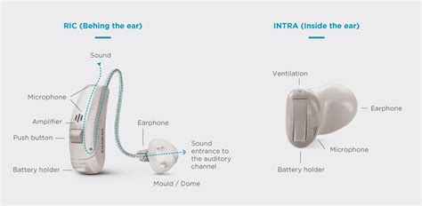 Hearing Aid Parts Diagram - General Wiring Diagram