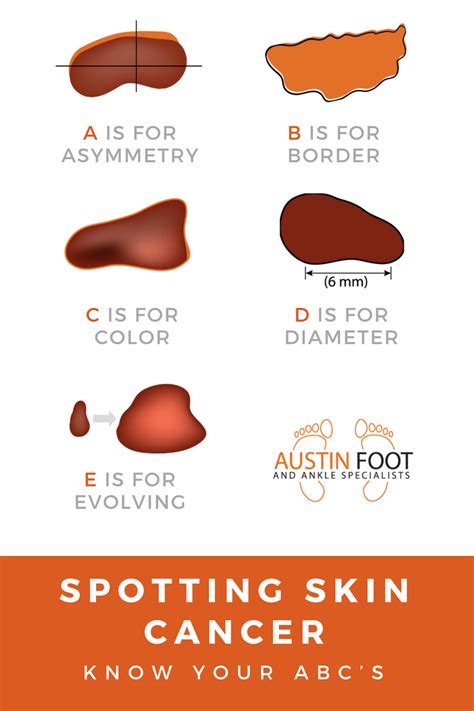 Spotting Skin Cancer Austin Foot And Ankle Specialists