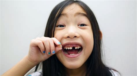 It is not that rare for someone to experience a loose tooth. Marisa pulls out her front wiggly tooth - YouTube