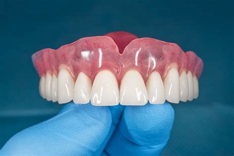 Full And Partial Dentures New Hope Dental Care