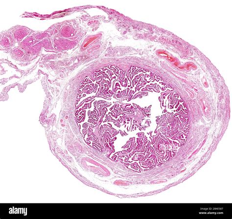The Fallopian Tubes Cut Out Stock Images And Pictures Alamy