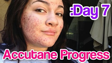 Day 7 Accutane Severe Acne Update Youtube