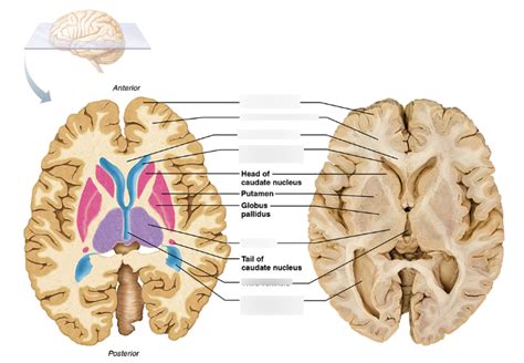 Brain Transverse Section Diagram Quizlet
