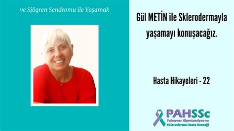 Hasta Hikayeleri Gül Metİn Skleroderma Ve Sjögren Sendromu Ile