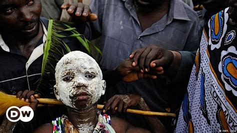 Ugandan Circumcision Ceremony Becomes A Tourist Attraction Dw