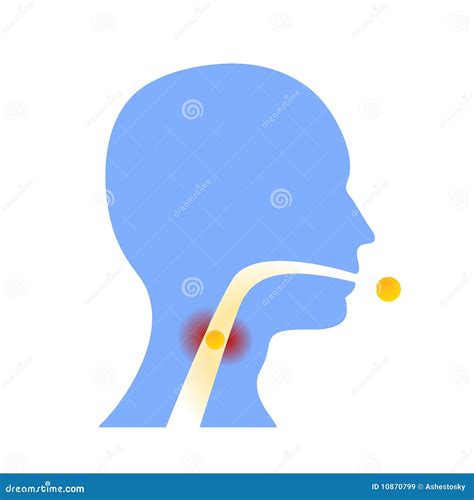 Sore Throat Side Profile Silhouettes With Ache Locations Adult And