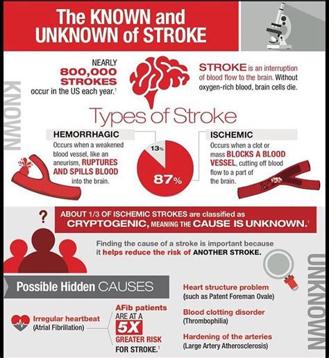 Some Causes Of Stroke Are Unknown What Do You Know About Cryptogenic