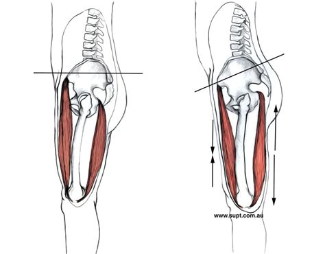 • low levels of endurance of back muscles are reported as cause and effect of low back pain. Does Anterior Pelvic Tilt Cause Back Pain - Exercise Right.