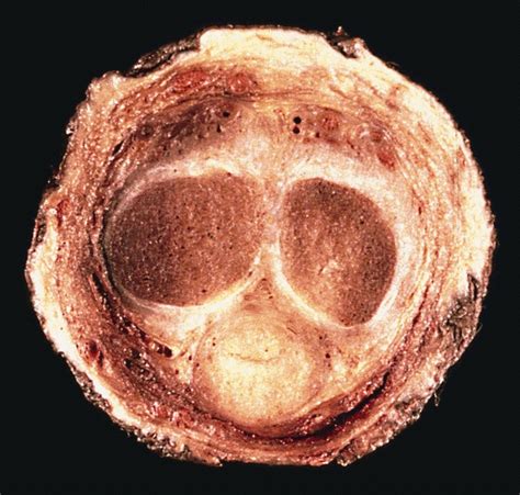 Pathology Outlines - Anatomy & histology-penis