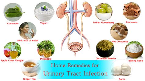 Here's what you need to know about preventing utis. Pin on 5 Home Remedies For UTIs