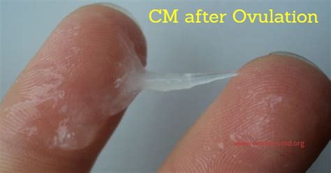 Cervical Mucus After Ovulation And If Pregnant Is It Creamy Egg White Or Watery — Brighter