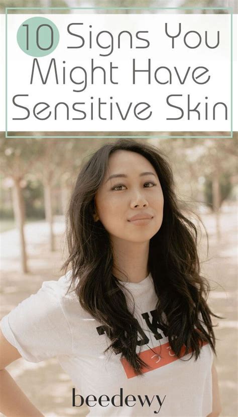 10 Signs You May Have Sensitive Skin Sensitive Skin Skin Skin Care Tips