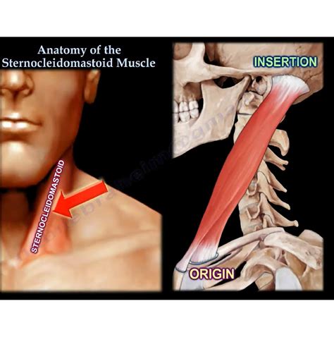 Anatomy Of The Sternocleidomastoid Muscle —