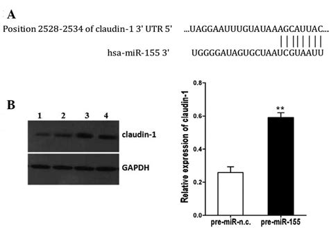 Upregulation Of Microrna 155 Promotes The Migration And Invasion Of