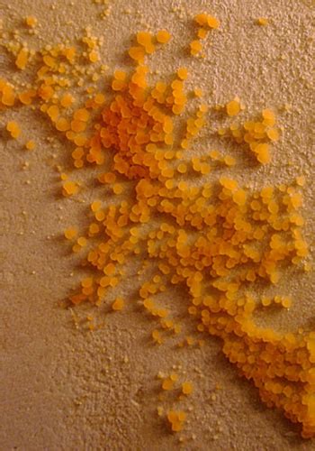 In the bathroom sometimes mold and mildew can accumulate through lack of proper ventilation for whatever reason there's some. Orange Mold in Bathroom