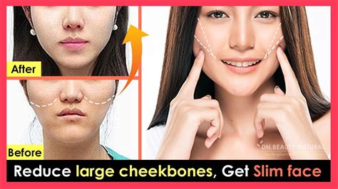 How To Reduce Large Cheekbones And High Cheekbones To Make The Face