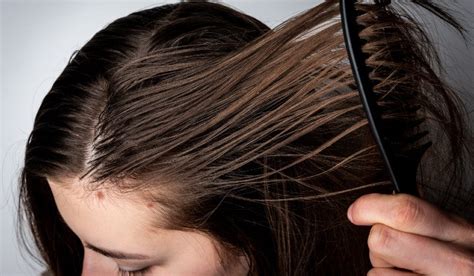 How To Treat An Oily Scalp Causes And Remedies Abyssian