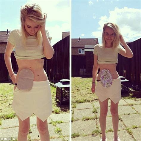 Woman With Bowel Condition Mortified To Be Told She Was Scaring The
