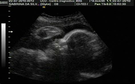 Simple Science: How to Make a Volcano with Kids