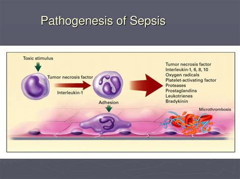 Pathogenesis Of Sepsis Hot Sex Picture
