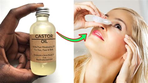 6 Benefits Of Castor Oil For Eyes Youtube