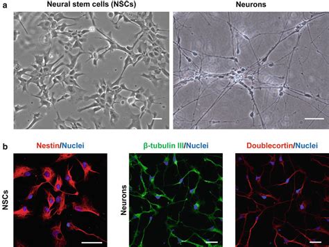Characterization Of Neural Stem Cells Nscs And Differentiated