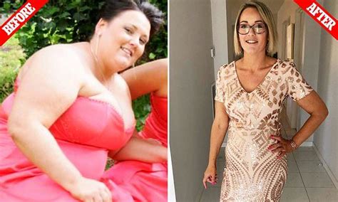 Morbidly Obese Woman Sheds Half Her Body Weight Obese Women Body Weight Obesity