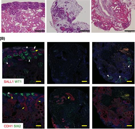 Hypoplastic Kidneys Of F1 Progeny Carrying Sall1 Mutations Left