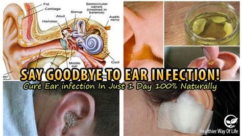 Say Goodbye To Ear Infection Cure Ear Infection In Just 1 Day 100