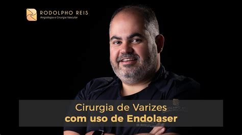 Cirurgia De Varizes Uso Do Endolaser YouTube