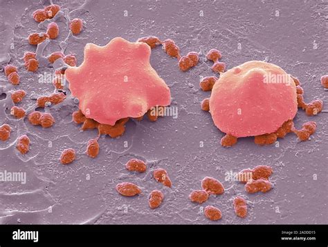 Streptococcus Pneumoniae Coloured Scanning Electron Micrograph Sem