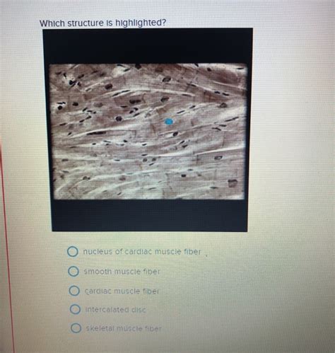We did not find results for: Solved: Which Structure Is Highlighted? O Cardiac Muscle F ...