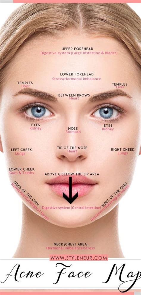 Acne Chart Reasons ~ Acne Chart Reasons Acne Face Chart Face Mapping Acne Acne Chart Face