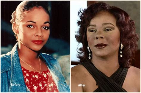 Top 10 Worst Celebrity Plastic Surgery Disasters From Hollywood Why