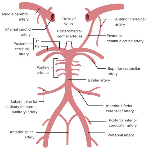 Posterior Inferior Cerebellar Artery Syndrome