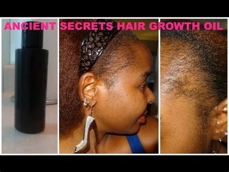 How to Get Your Edges Back w/ Cayenne Pepper & JBCO ...