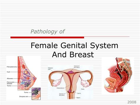 Pathology Of Female Reproductive System Nibblepic